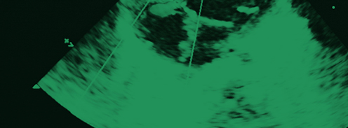 39408-FlyerGross.png